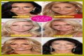 Botox, Implants & More! – Hollywood Life
